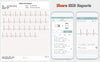 Portable ECG Monitor (for iPhone & Android, Mac & Windows) | Wireless EKG Monitoring Devices with Heart Rate & Rhythm Tracking